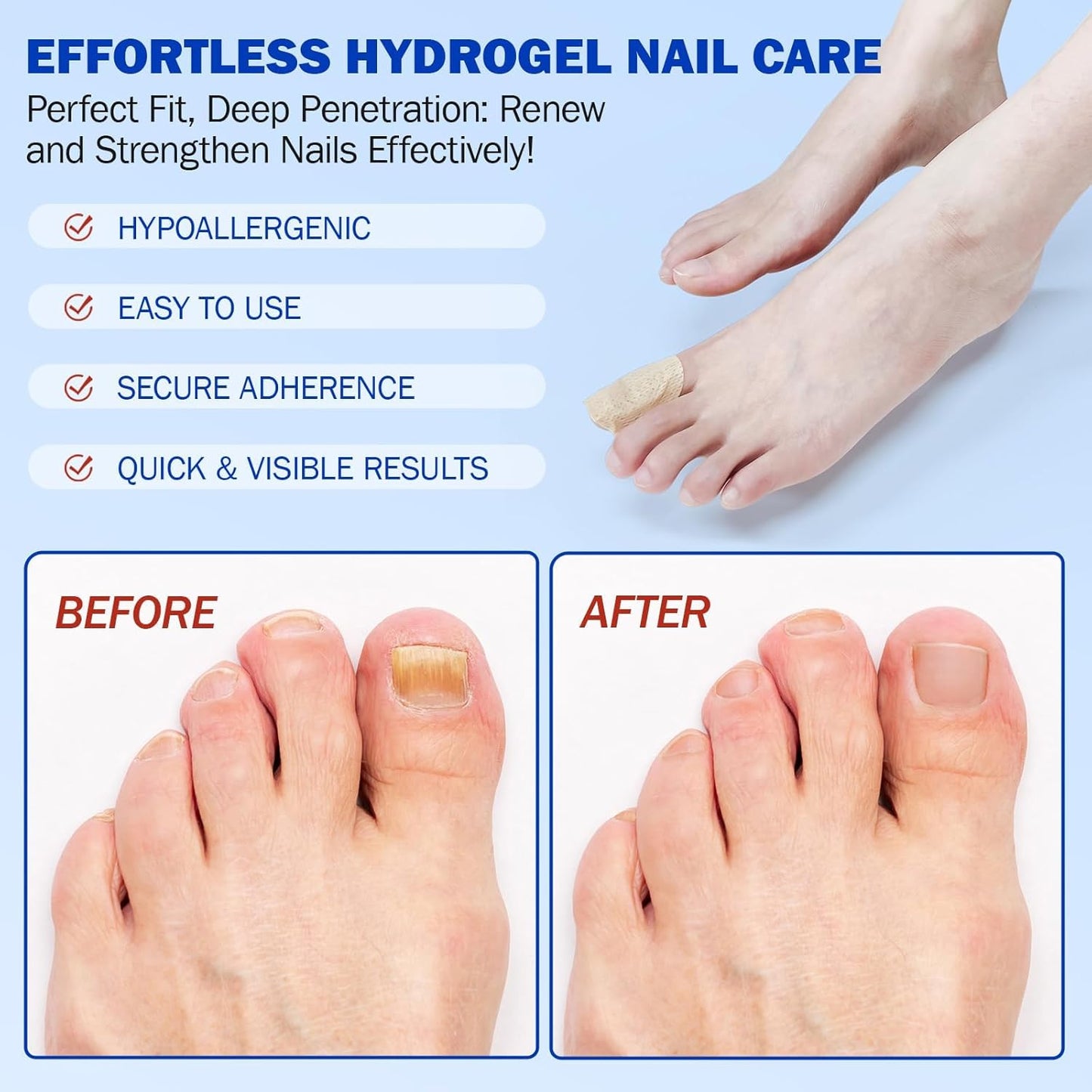 Fungal Nail Patches