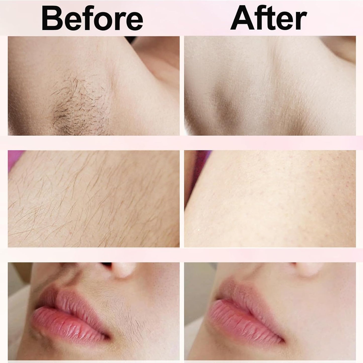 Bikini Trimmer for Women - Painless Electric Razors for Silk Skin
