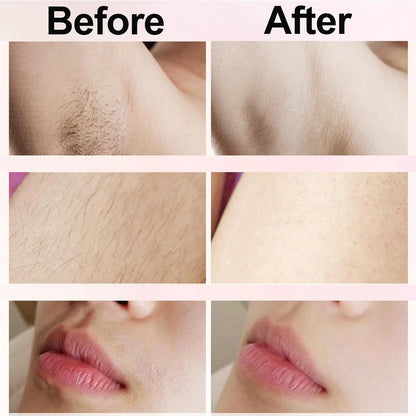 Bikini Trimmer for Women - Painless Electric Razors for Silk Skin