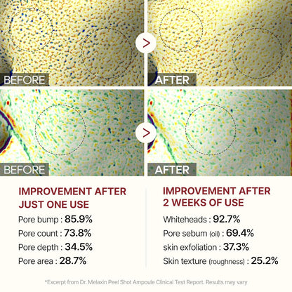 Peel Shot Glow White and Black Rice Ampoule Duo